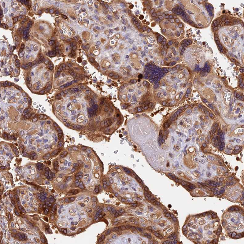 Atlas Antibodies Anti-ARHGAP17 Antibody