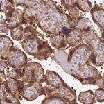 Atlas Antibodies Anti-ARHGAP17 Antibody