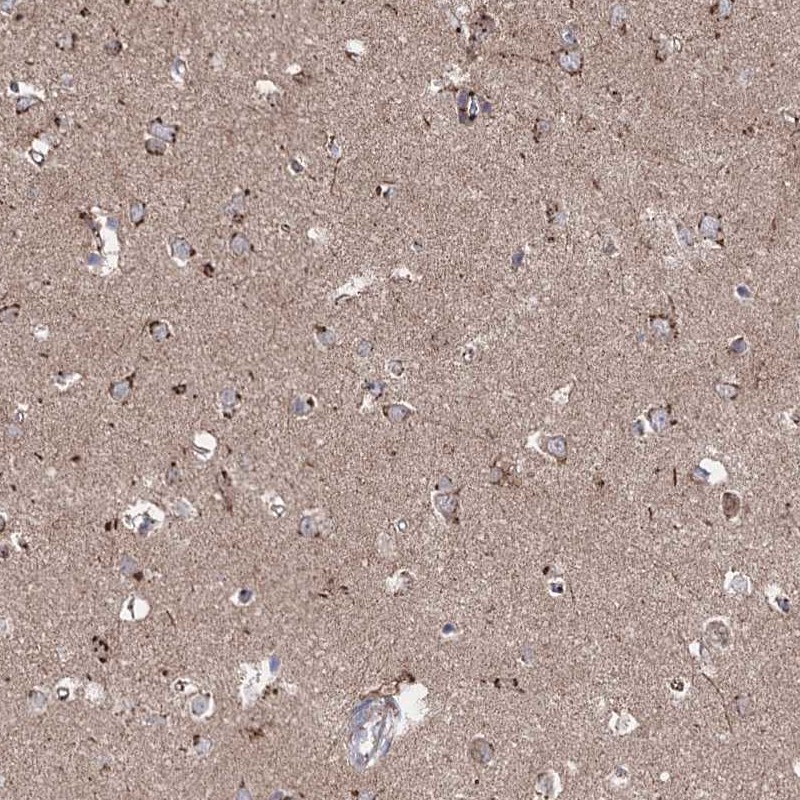 Atlas Antibodies Anti-ARHGAP20 Antibody