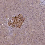 Atlas Antibodies Anti-ARHGAP19 Antibody