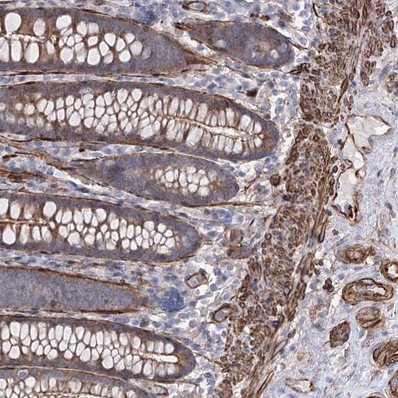 Atlas Antibodies Anti-ARHGAP20 Antibody