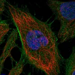 Atlas Antibodies Anti-ARHGAP21 Antibody