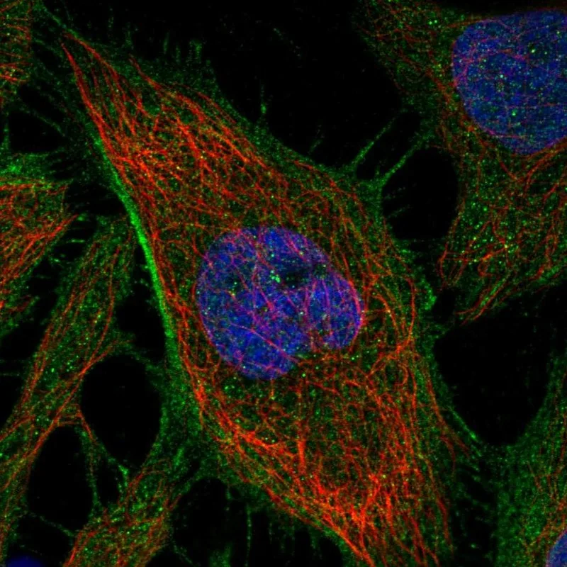 Atlas Antibodies Anti-ARHGAP21 Antibody