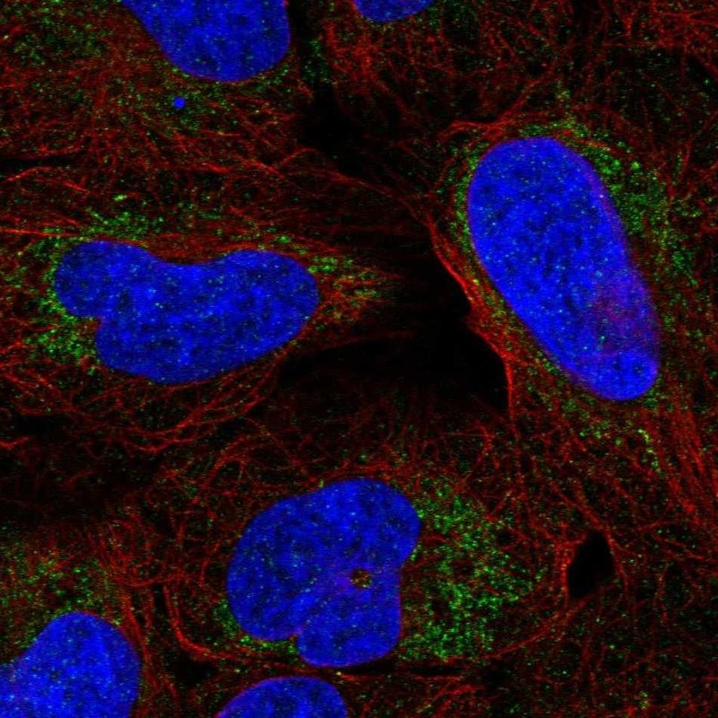 Atlas Antibodies Anti-ARHGAP20 Antibody