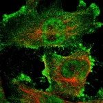 Atlas Antibodies Anti-ARHGAP23 Antibody