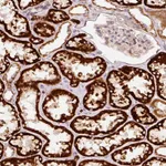 Atlas Antibodies Anti-ARHGAP22 Antibody