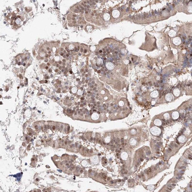 Atlas Antibodies Anti-ARHGAP21 Antibody