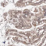 Atlas Antibodies Anti-ARHGAP21 Antibody