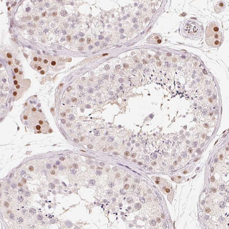 Atlas Antibodies Anti-ARHGAP22 Antibody