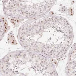 Atlas Antibodies Anti-ARHGAP22 Antibody