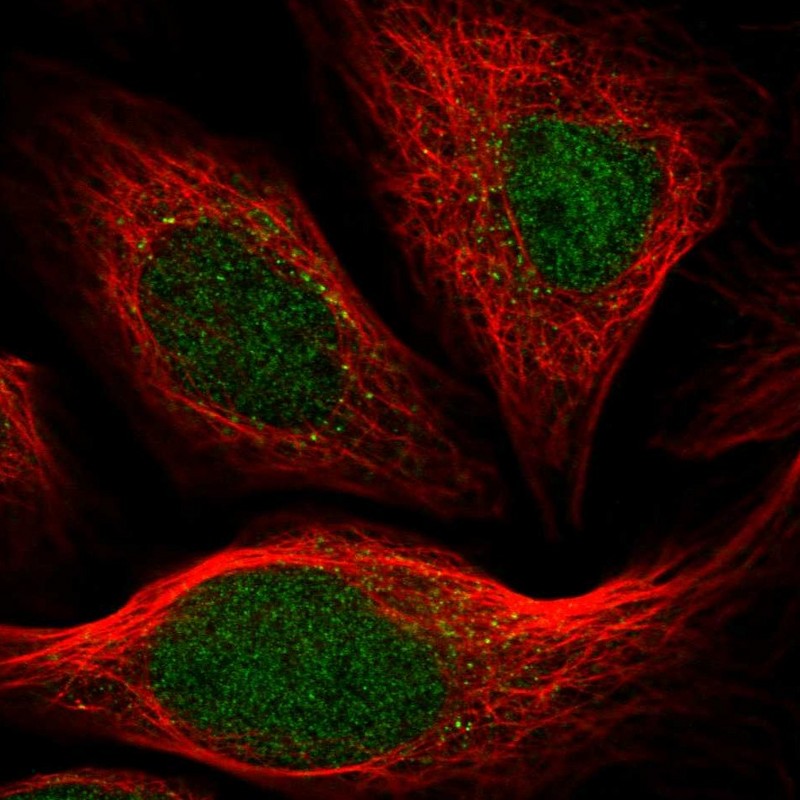 Atlas Antibodies Anti-ARHGAP23 Antibody