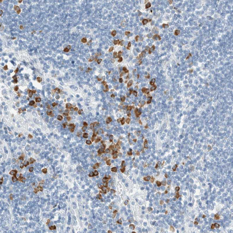 Atlas Antibodies Anti-ARHGAP27 Antibody
