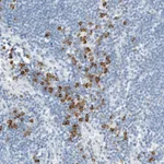 Atlas Antibodies Anti-ARHGAP27 Antibody