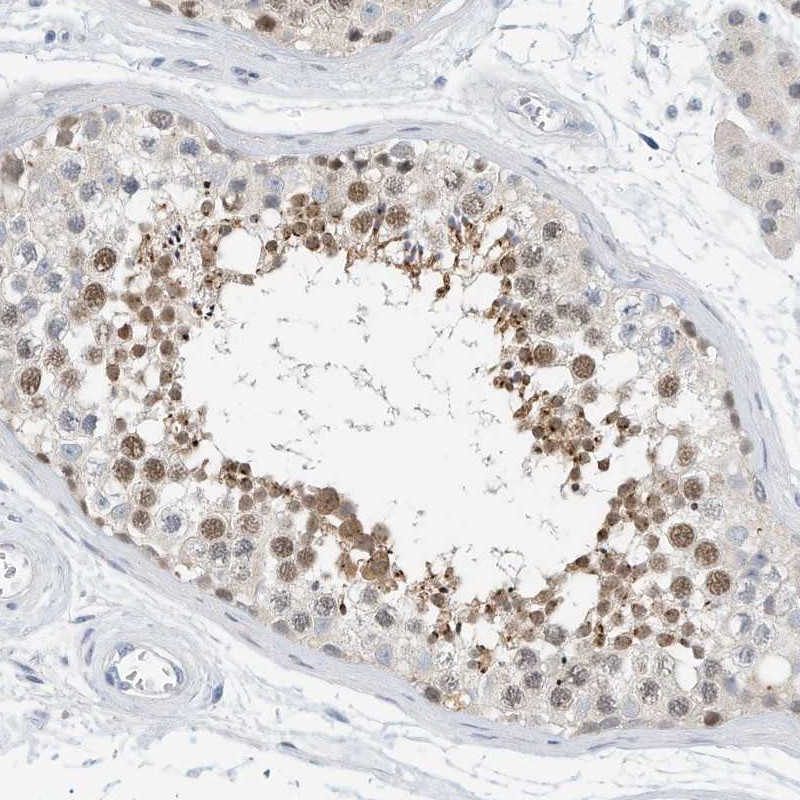 Atlas Antibodies Anti-ARHGAP28 Antibody