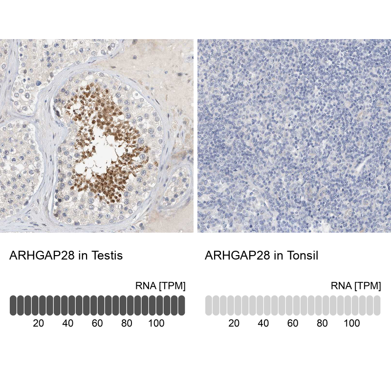 Atlas Antibodies Anti-ARHGAP28 Antibody