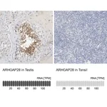 Atlas Antibodies Anti-ARHGAP28 Antibody