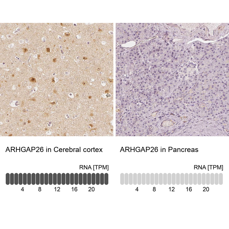 Atlas Antibodies Anti-ARHGAP26 Antibody