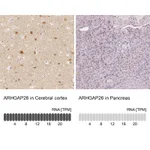 Atlas Antibodies Anti-ARHGAP26 Antibody