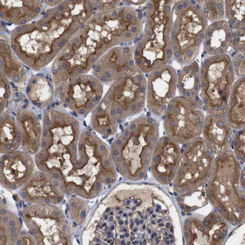 Atlas Antibodies Anti-ARHGAP24 Antibody