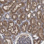 Atlas Antibodies Anti-ARHGAP24 Antibody