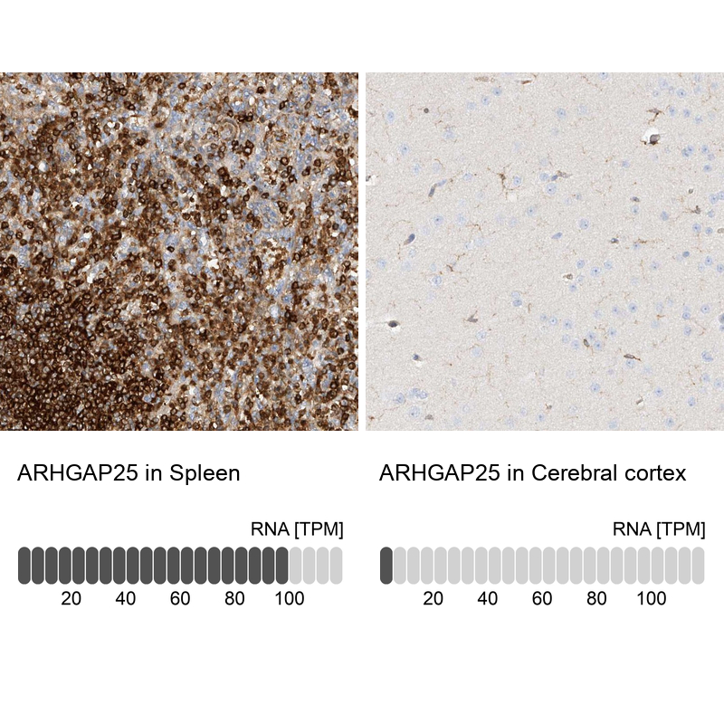 Atlas Antibodies Anti-ARHGAP25 Antibody