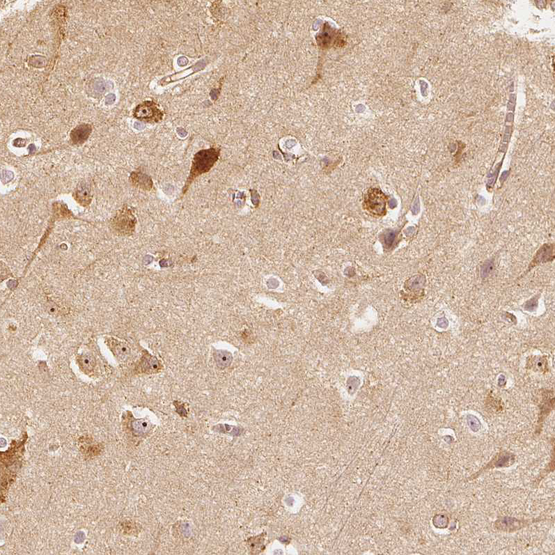 Atlas Antibodies Anti-ARHGAP26 Antibody