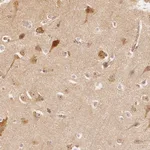 Atlas Antibodies Anti-ARHGAP26 Antibody