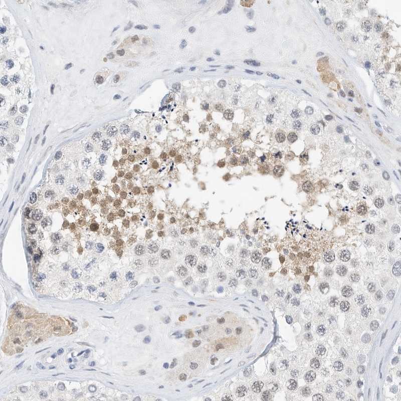 Atlas Antibodies Anti-ARHGAP28 Antibody