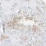 Atlas Antibodies Anti-ARHGAP28 Antibody