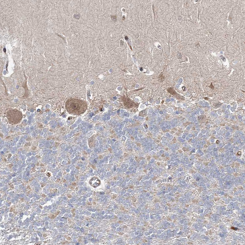 Atlas Antibodies Anti-ARHGAP32 Antibody