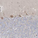 Atlas Antibodies Anti-ARHGAP32 Antibody
