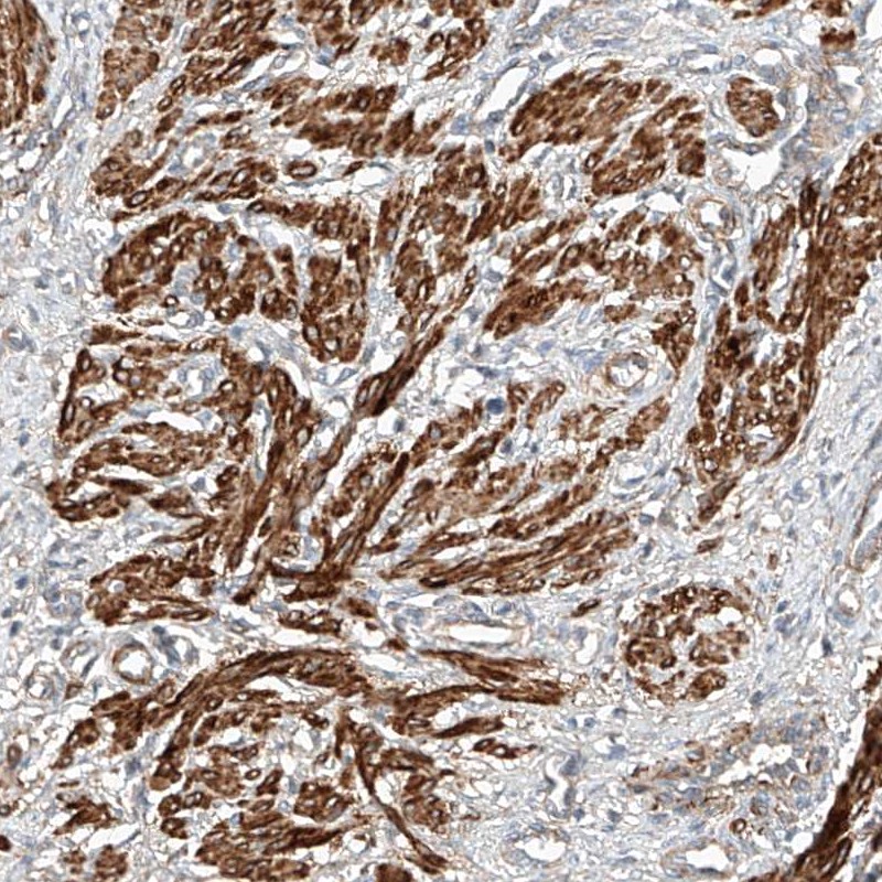 Atlas Antibodies Anti-ARHGAP33 Antibody