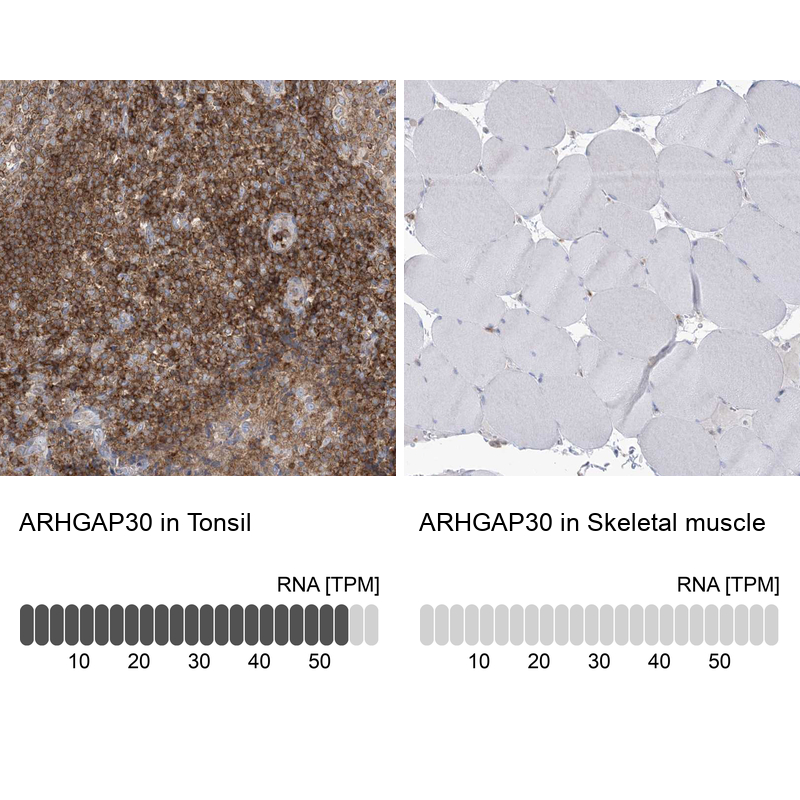 Atlas Antibodies Anti-ARHGAP30 Antibody