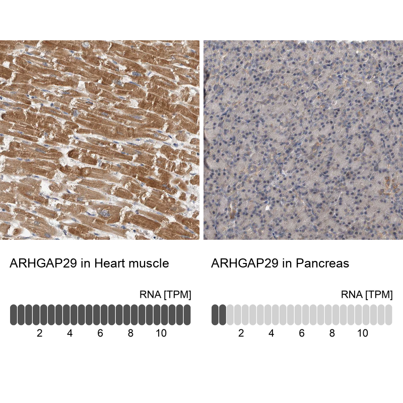 Atlas Antibodies Anti-ARHGAP29 Antibody