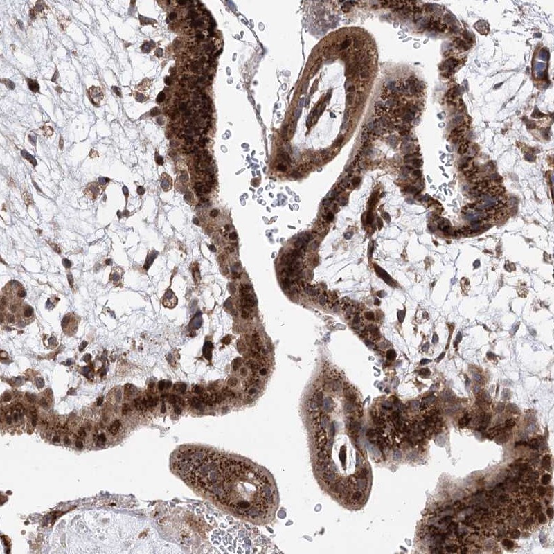 Atlas Antibodies Anti-ARHGAP31 Antibody
