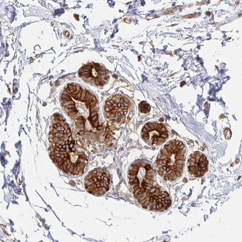 Atlas Antibodies Anti-ARHGAP35 Antibody