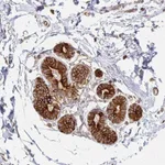 Atlas Antibodies Anti-ARHGAP35 Antibody