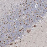 Atlas Antibodies Anti-ARHGAP32 Antibody