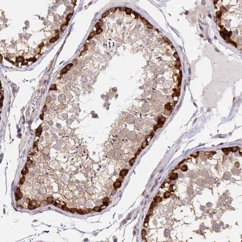 Atlas Antibodies Anti-ARHGAP35 Antibody