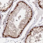 Atlas Antibodies Anti-ARHGAP35 Antibody