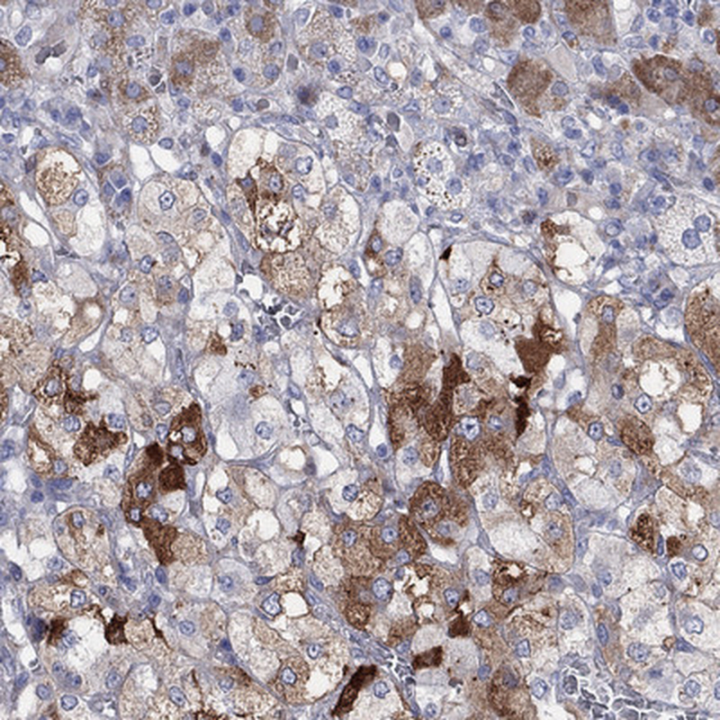 Atlas Antibodies Anti-ARHGAP36 Antibody