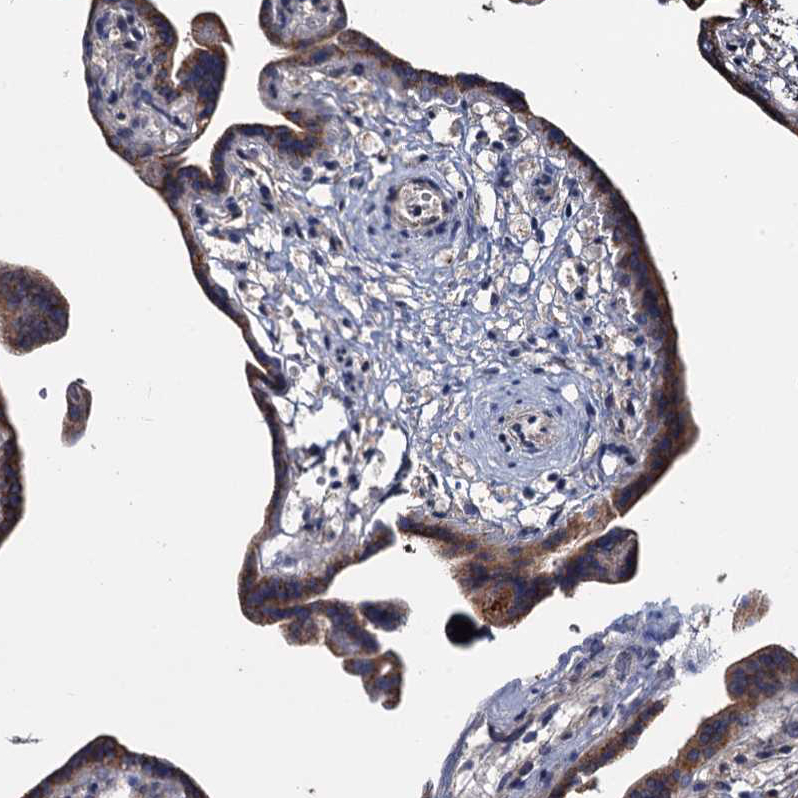Atlas Antibodies Anti-ARHGAP42 Antibody