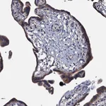 Atlas Antibodies Anti-ARHGAP42 Antibody