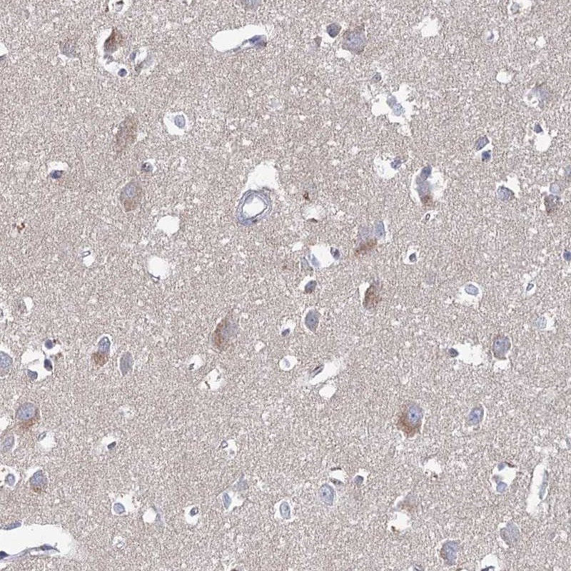 Atlas Antibodies Anti-ARHGAP44 Antibody