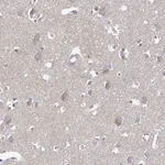Atlas Antibodies Anti-ARHGAP44 Antibody