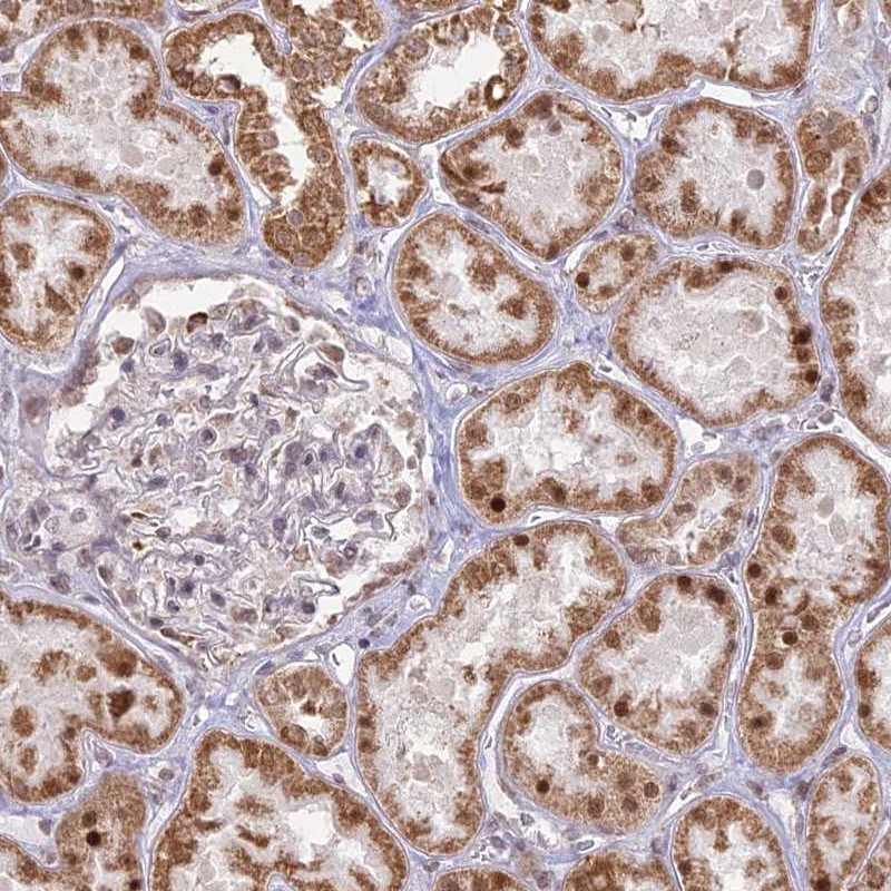 Atlas Antibodies Anti-ARHGAP40 Antibody
