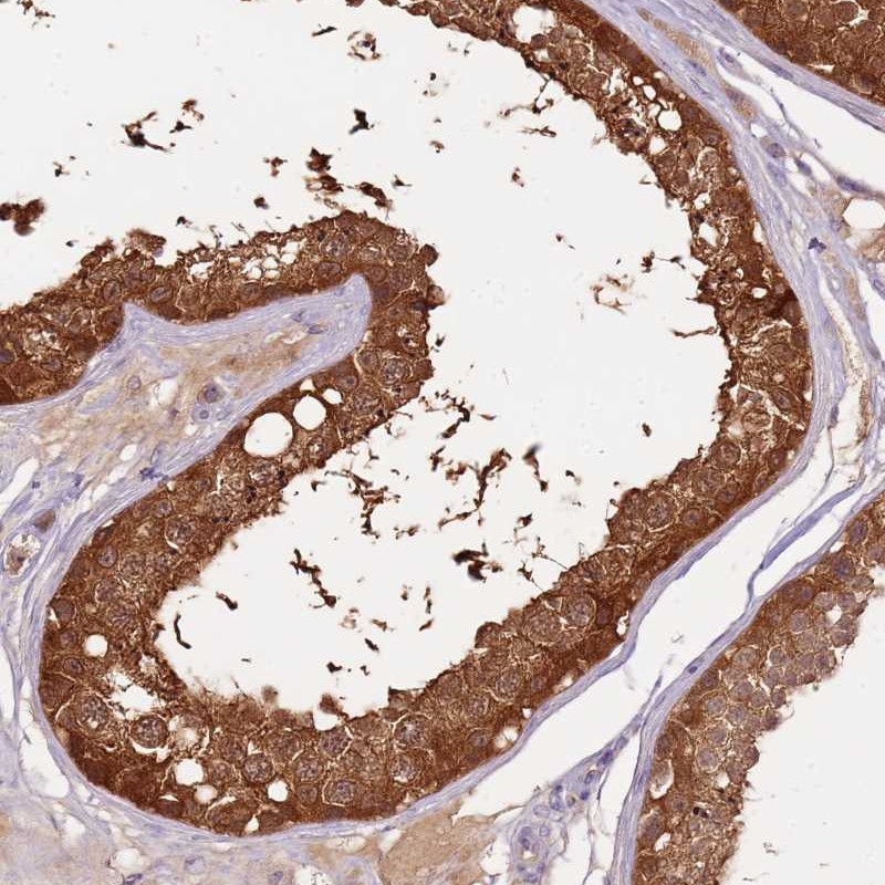 Atlas Antibodies Anti-ARHGAP5 Antibody