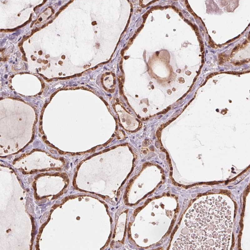 Atlas Antibodies Anti-ARHGAP6 Antibody