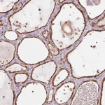 Atlas Antibodies Anti-ARHGAP6 Antibody