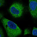 Atlas Antibodies Anti-ARHGAP5 Antibody